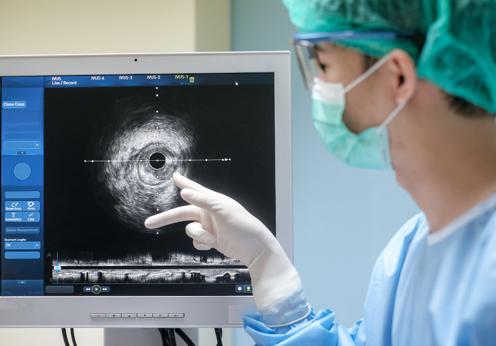 Medico visualizando no monitor um cateter