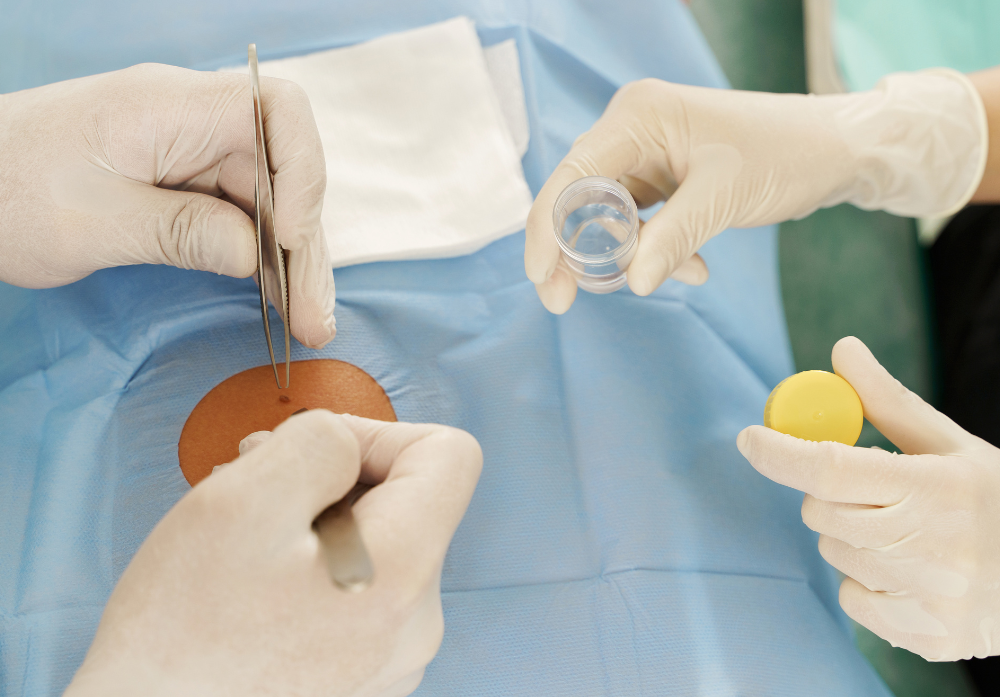 Cirurgias Dermatológicas