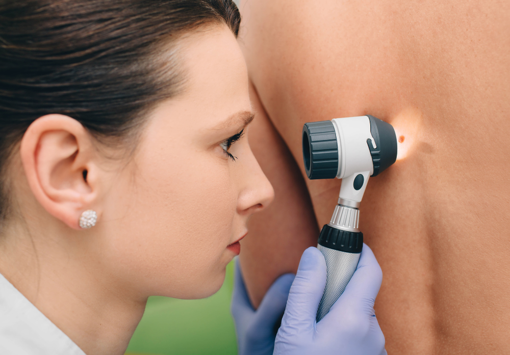 Médica em um Exame Dermatológico nas costas de um Paciente