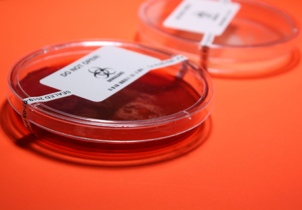 Imagem de material contaminante preparado para exame